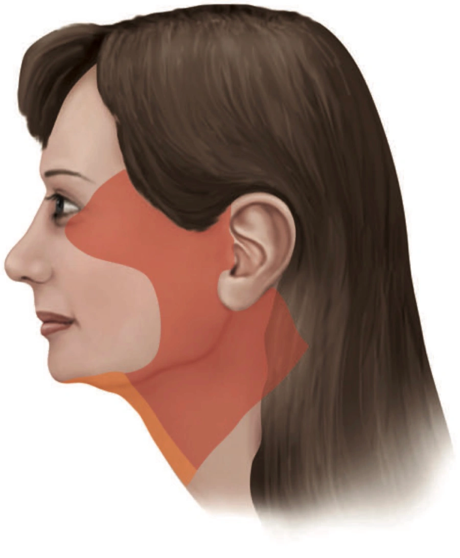 facelift for Caucasian Face