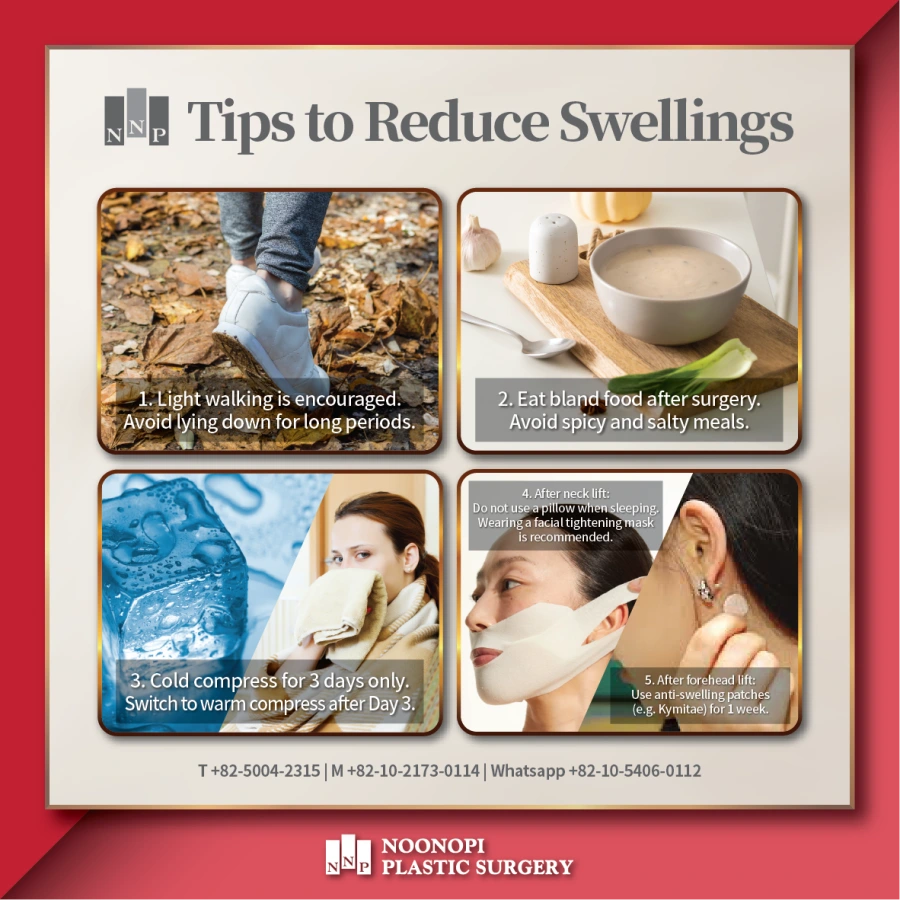 Post op care to reduce swelling