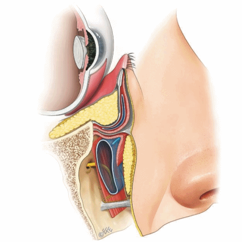 eyebag removal surgery