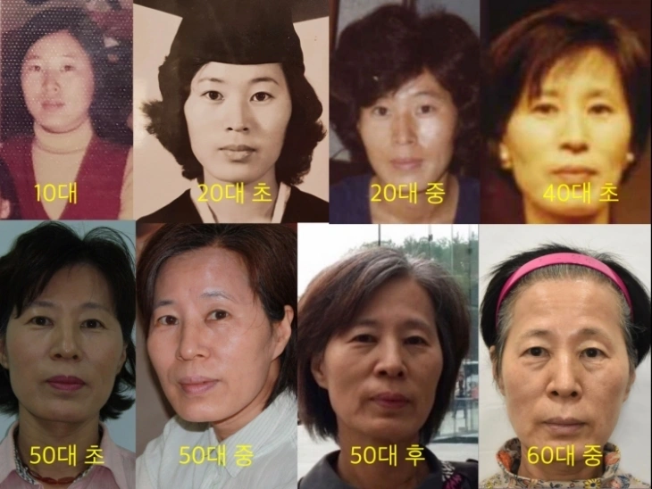 나이들면서 생기는 얼굴의 변화