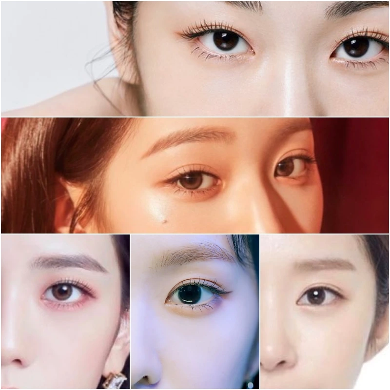 double eyelid types in Korea
