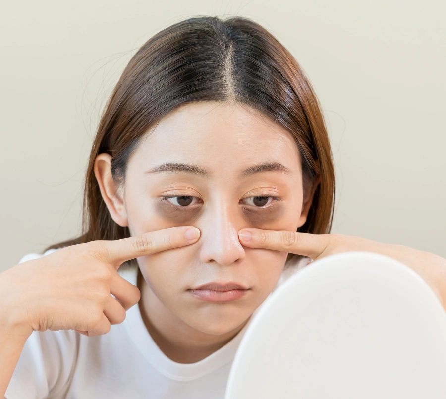 lower blepharoplasty for eye bags and hollow eyes