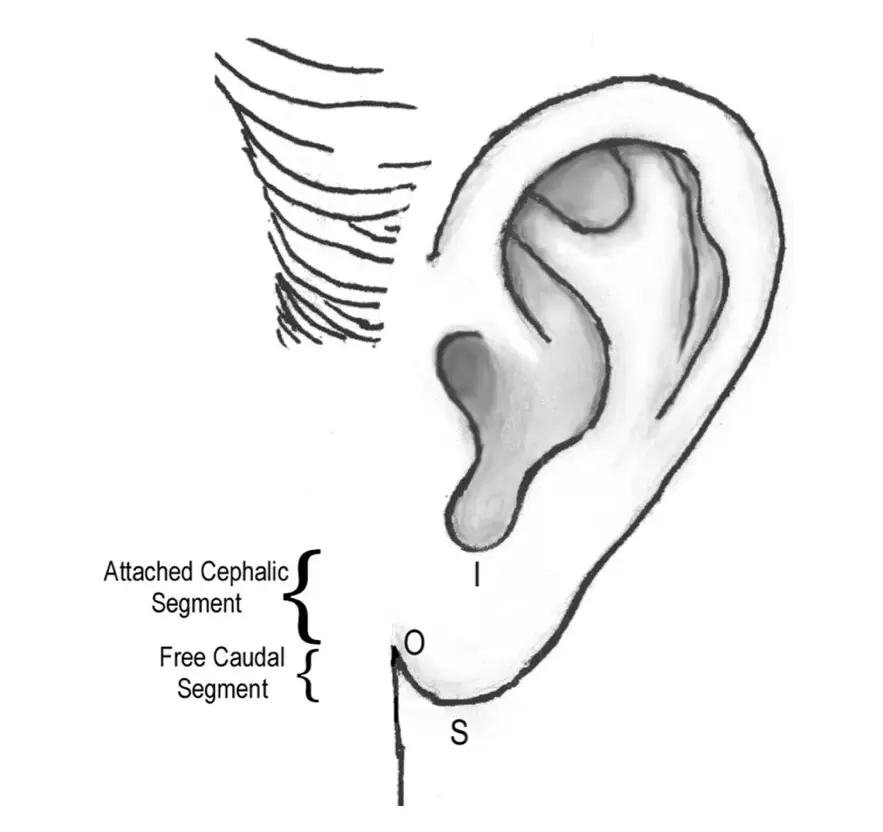 feature of aesthetic earlobe