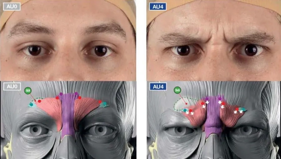 Muscles responsible for frown lines between the eyebrows