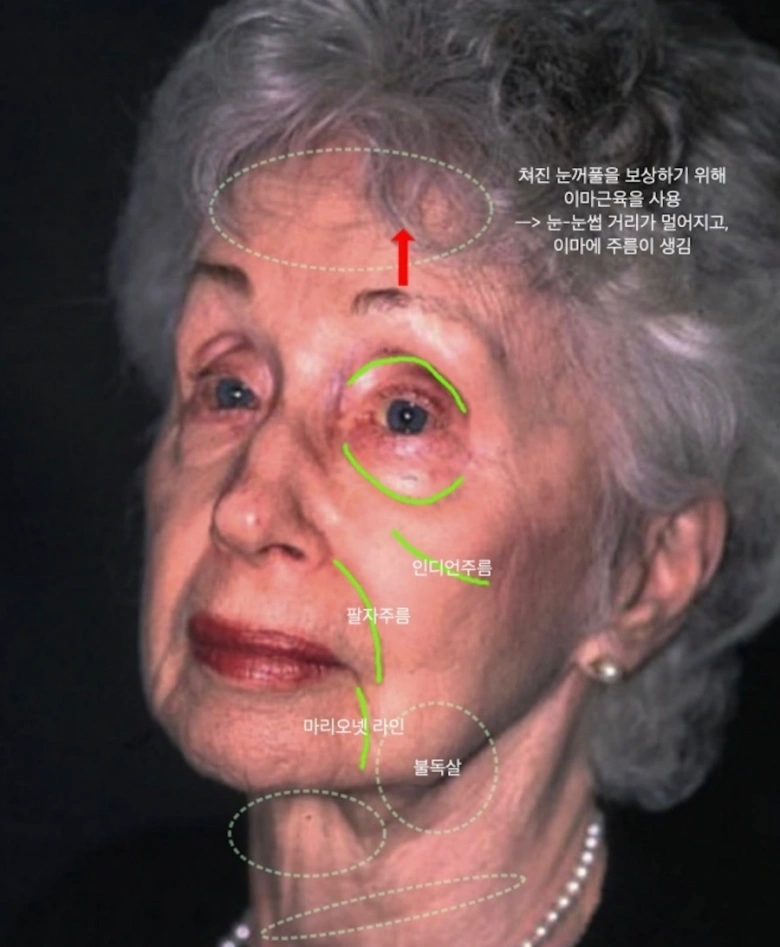 나이든 얼굴의 특징